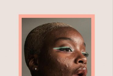 Acne - the Skinfident series