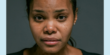 grief and loss