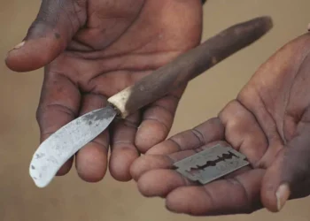 An image used to illustrate Female Genital Mutilation